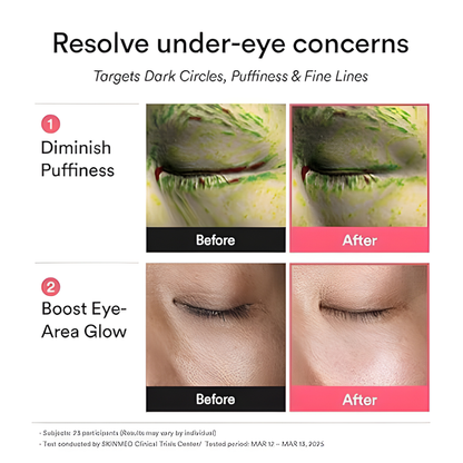LumiEyes™ Under-Eye Brightening & Depuffing Hydrogel Patches - LumiSkin Co