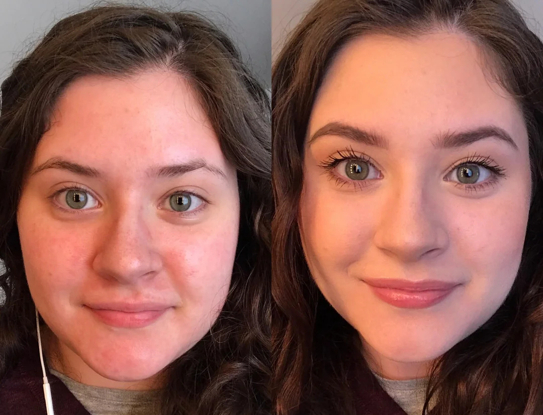 LumiEyes™ Under-Eye Brightening & Depuffing Hydrogel Patches