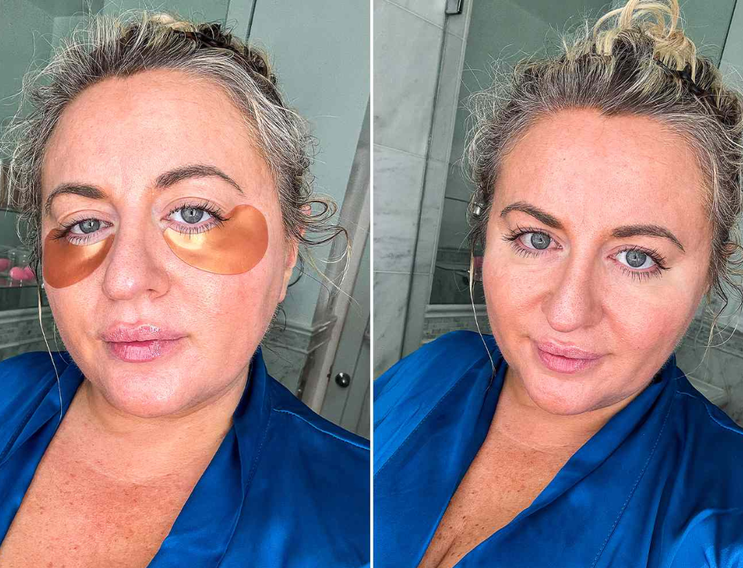 LumiEyes™ Under-Eye Brightening & Depuffing Hydrogel Patches